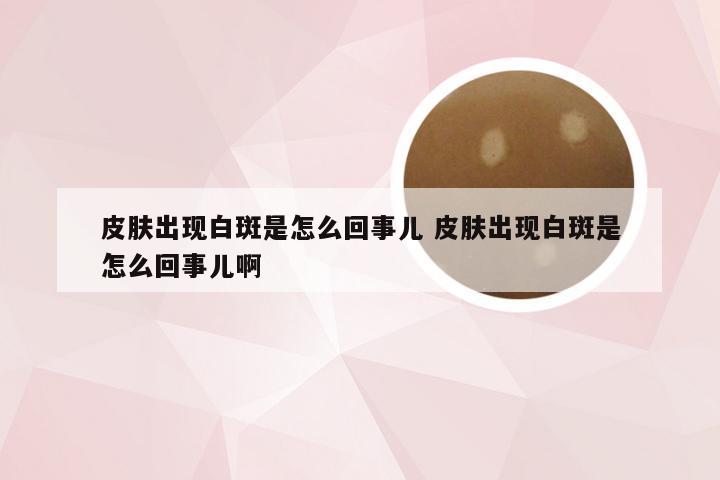 皮肤出现白斑是怎么回事儿 皮肤出现白斑是怎么回事儿啊