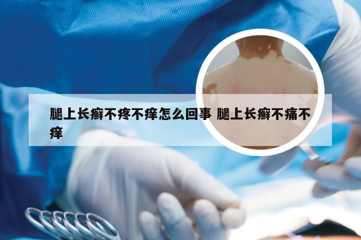 腿上长癣不疼不痒怎么回事 腿上长癣不痛不痒