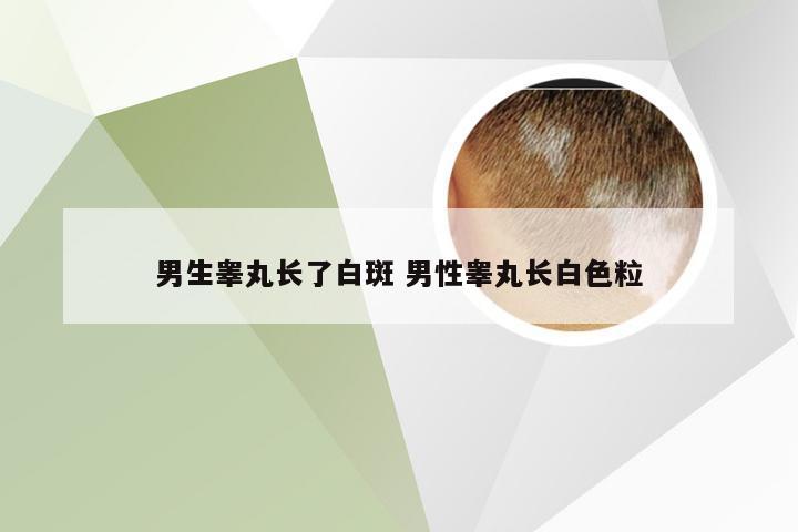 男生睾丸长了白斑 男性睾丸长白色粒