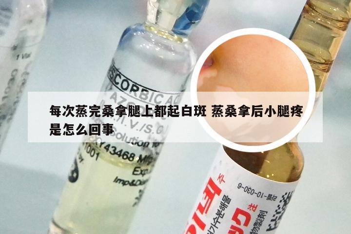 每次蒸完桑拿腿上都起白斑 蒸桑拿后小腿疼是怎么回事