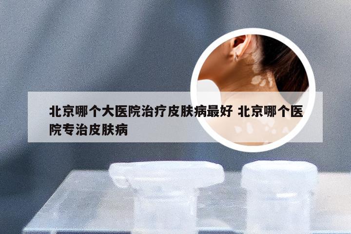 北京哪个大医院治疗皮肤病最好 北京哪个医院专治皮肤病
