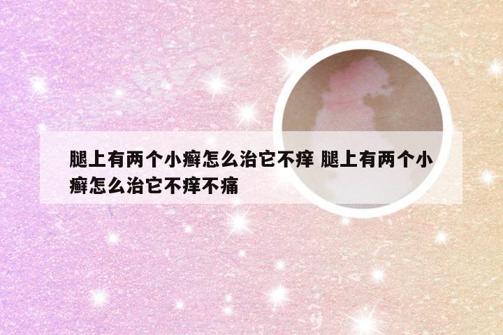 腿上有两个小癣怎么治它不痒 腿上有两个小癣怎么治它不痒不痛