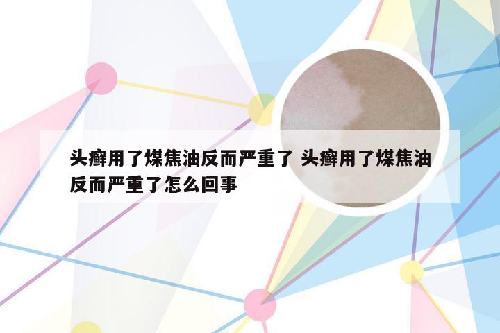 头癣用了煤焦油反而严重了 头癣用了煤焦油反而严重了怎么回事