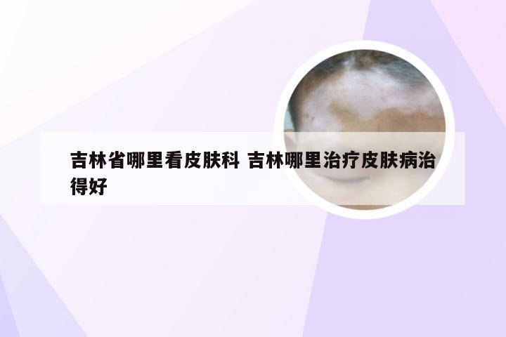 吉林省哪里看皮肤科 吉林哪里治疗皮肤病治得好