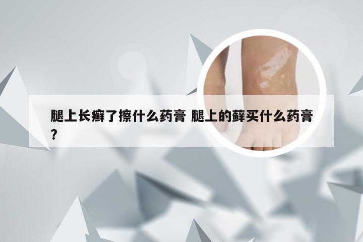 腿上长癣了擦什么药膏 腿上的藓买什么药膏?