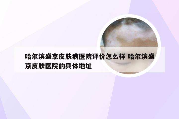 哈尔滨盛京皮肤病医院评价怎么样 哈尔滨盛京皮肤医院的具体地址