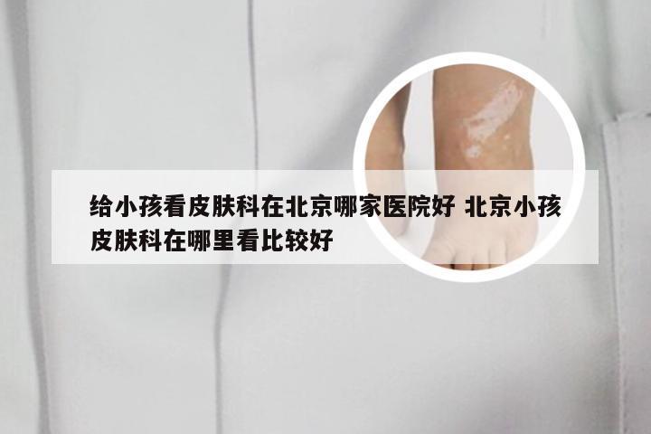 给小孩看皮肤科在北京哪家医院好 北京小孩皮肤科在哪里看比较好