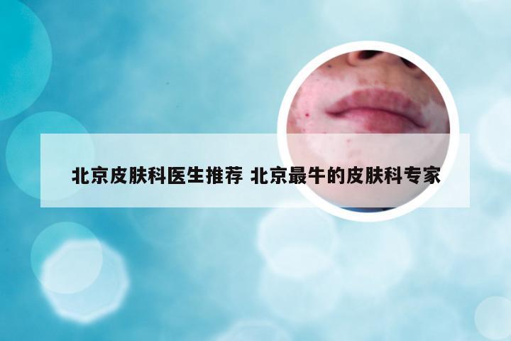 北京皮肤科医生推荐 北京最牛的皮肤科专家