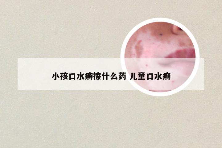 小孩口水癣擦什么药 儿童口水癣