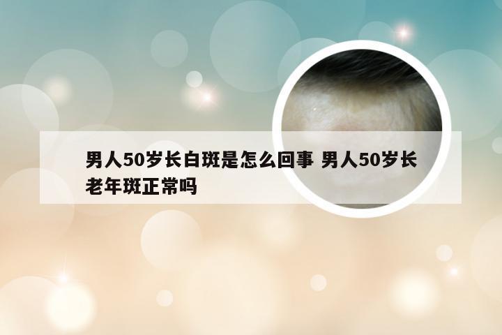 男人50岁长白斑是怎么回事 男人50岁长老年斑正常吗