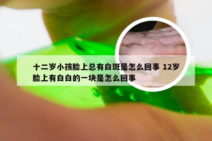 十二岁小孩脸上总有白斑是怎么回事 12岁脸上有白白的一块是怎么回事