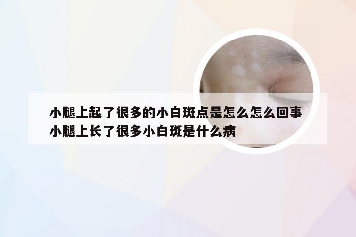 小腿上起了很多的小白斑点是怎么怎么回事 小腿上长了很多小白斑是什么病