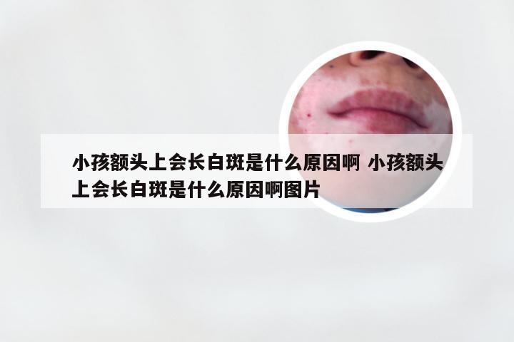 小孩额头上会长白斑是什么原因啊 小孩额头上会长白斑是什么原因啊图片