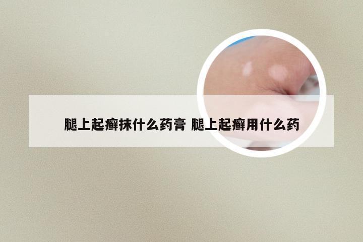 腿上起癣抹什么药膏 腿上起癣用什么药