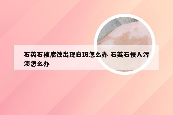 石英石被腐蚀出现白斑怎么办 石英石侵入污渍怎么办