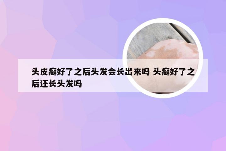 头皮癣好了之后头发会长出来吗 头癣好了之后还长头发吗