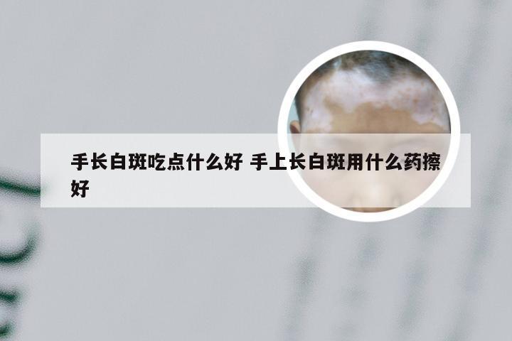 手长白斑吃点什么好 手上长白斑用什么药擦好