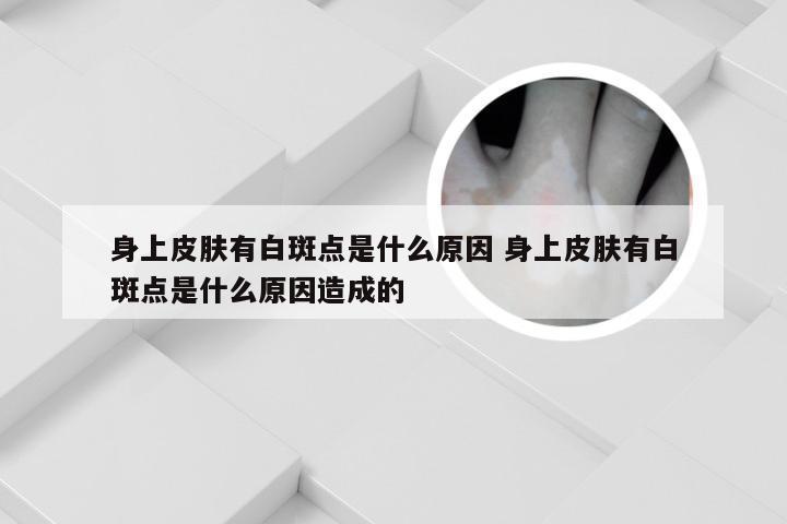 身上皮肤有白斑点是什么原因 身上皮肤有白斑点是什么原因造成的