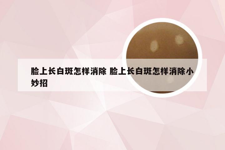 脸上长白斑怎样消除 脸上长白斑怎样消除小妙招