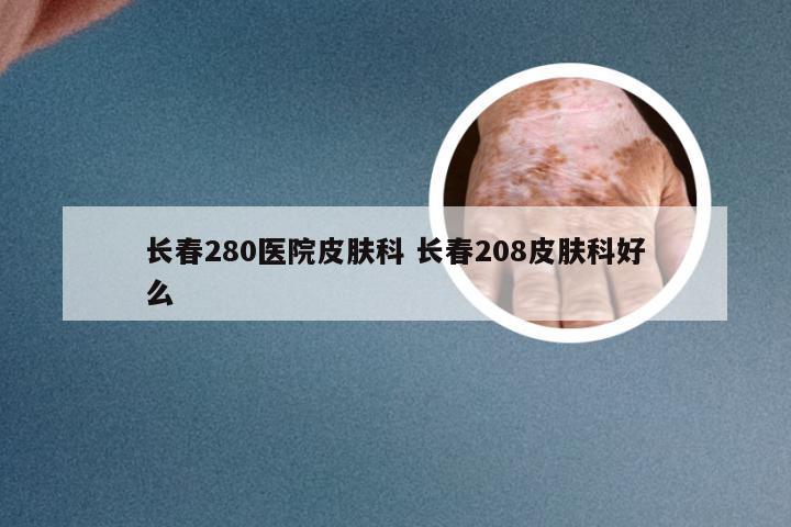 长春280医院皮肤科 长春208皮肤科好么