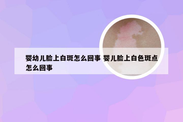 婴幼儿脸上白斑怎么回事 婴儿脸上白色斑点怎么回事