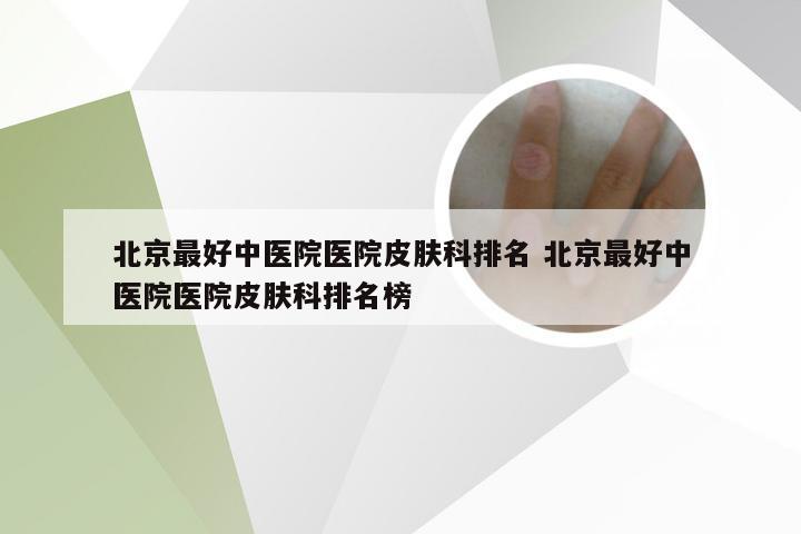 北京最好中医院医院皮肤科排名 北京最好中医院医院皮肤科排名榜