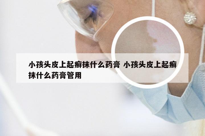 小孩头皮上起癣抹什么药膏 小孩头皮上起癣抹什么药膏管用