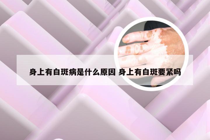 身上有白斑病是什么原因 身上有白斑要紧吗