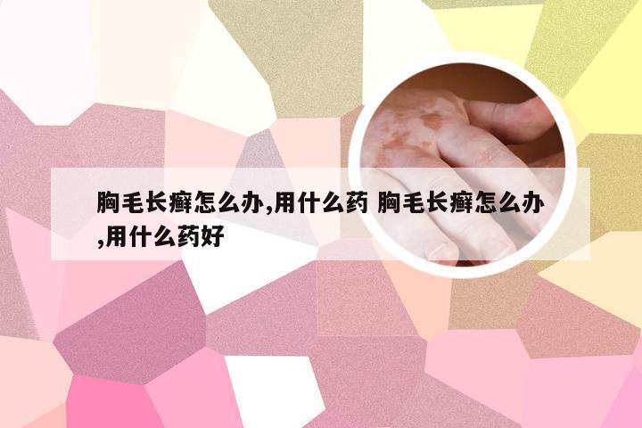 胸毛长癣怎么办,用什么药 胸毛长癣怎么办,用什么药好