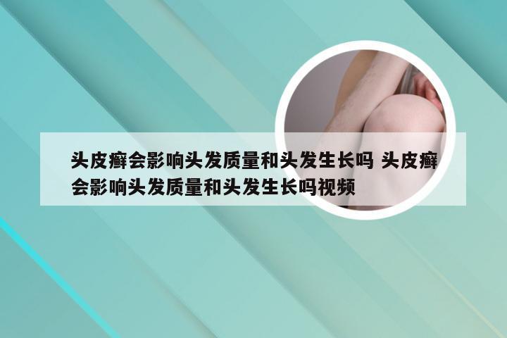 头皮癣会影响头发质量和头发生长吗 头皮癣会影响头发质量和头发生长吗视频