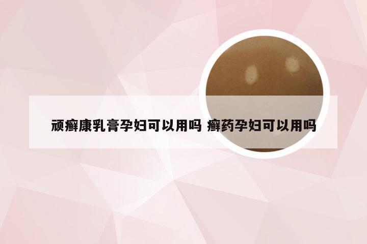 顽癣康乳膏孕妇可以用吗 癣药孕妇可以用吗