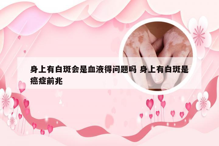 身上有白斑会是血液得问题吗 身上有白斑是癌症前兆