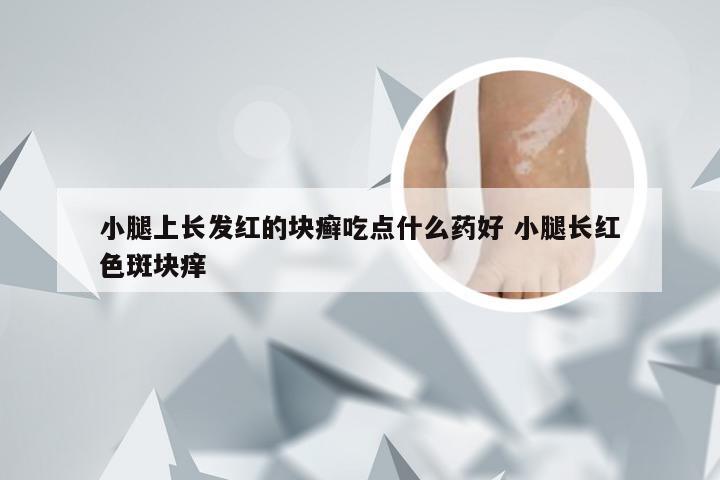 小腿上长发红的块癣吃点什么药好 小腿长红色斑块痒