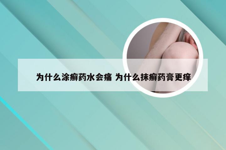 为什么涂癣药水会痛 为什么抹癣药膏更痒