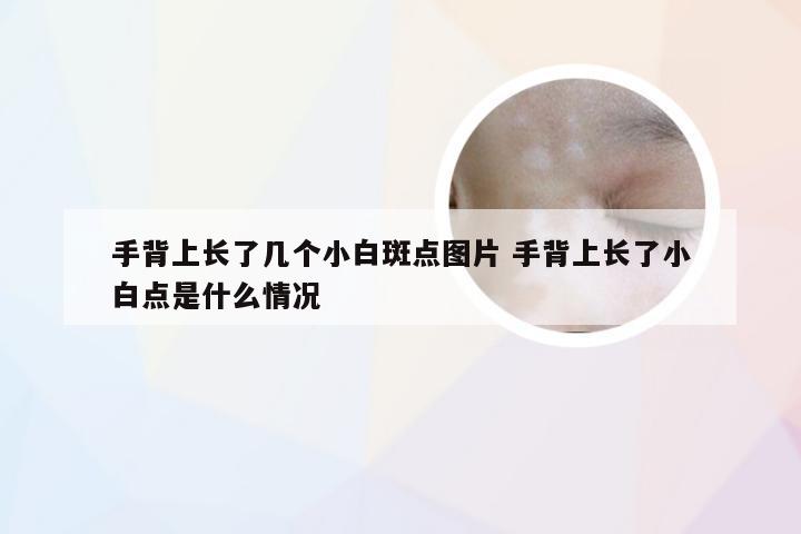 手背上长了几个小白斑点图片 手背上长了小白点是什么情况