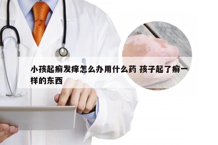 小孩起癣发痒怎么办用什么药 孩子起了癣一样的东西