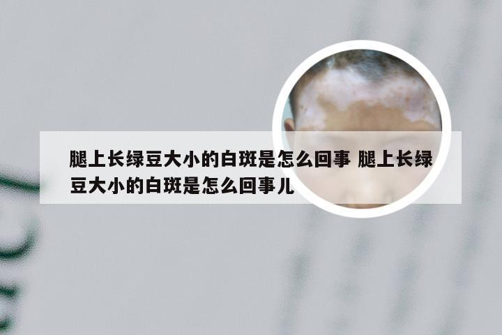 腿上长绿豆大小的白斑是怎么回事 腿上长绿豆大小的白斑是怎么回事儿