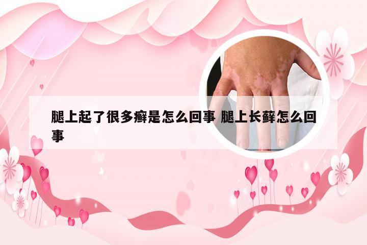 腿上起了很多癣是怎么回事 腿上长藓怎么回事