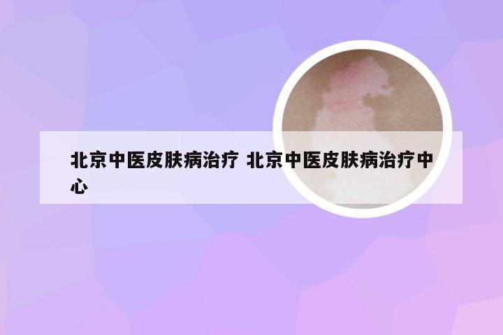 北京中医皮肤病治疗 北京中医皮肤病治疗中心