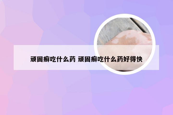 顽固癣吃什么药 顽固癣吃什么药好得快