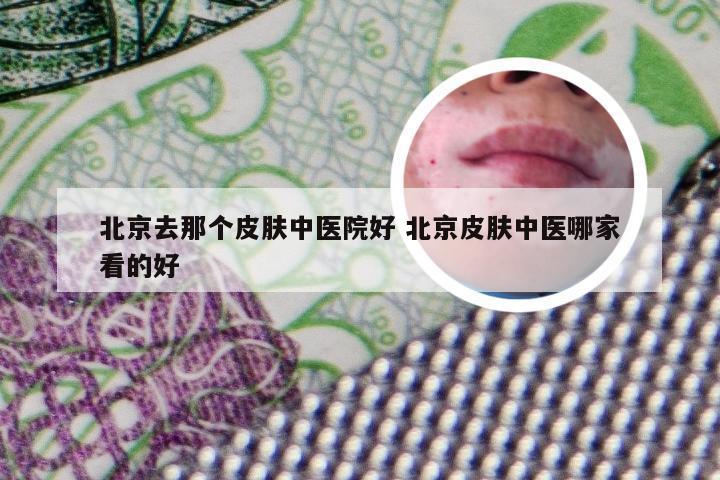 北京去那个皮肤中医院好 北京皮肤中医哪家看的好