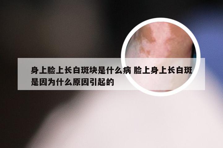 身上脸上长白斑块是什么病 脸上身上长白斑是因为什么原因引起的