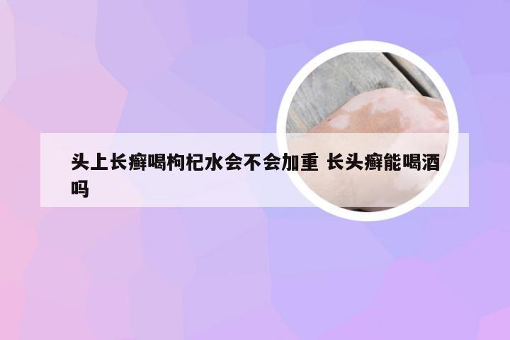 头上长癣喝枸杞水会不会加重 长头癣能喝酒吗