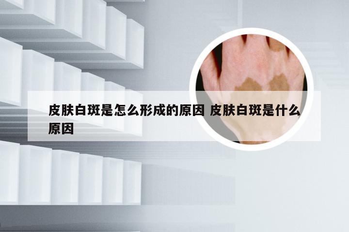 皮肤白斑是怎么形成的原因 皮肤白斑是什么原因