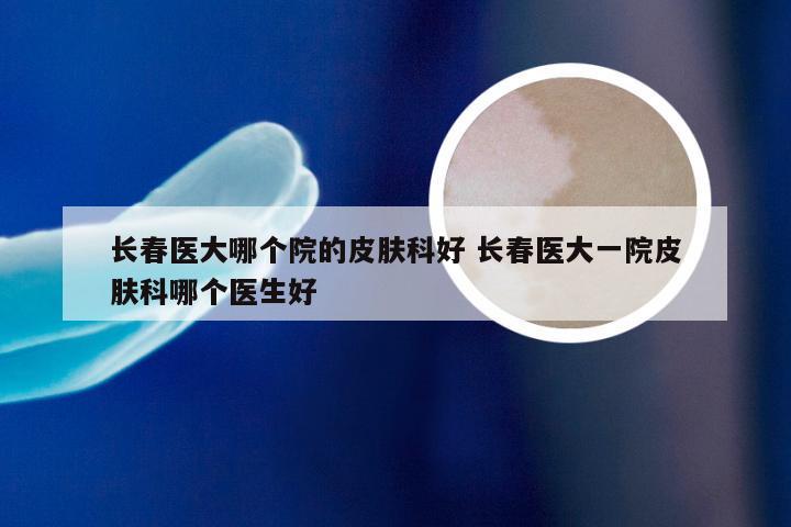 长春医大哪个院的皮肤科好 长春医大一院皮肤科哪个医生好