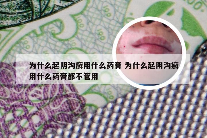 为什么起阴沟癣用什么药膏 为什么起阴沟癣用什么药膏都不管用