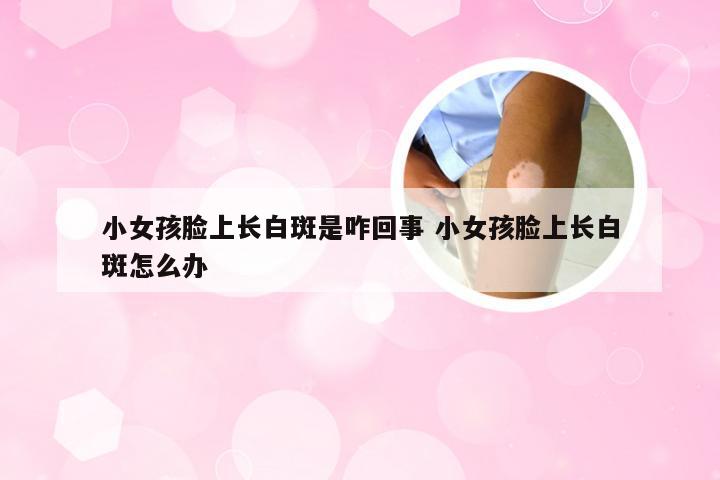 小女孩脸上长白斑是咋回事 小女孩脸上长白斑怎么办