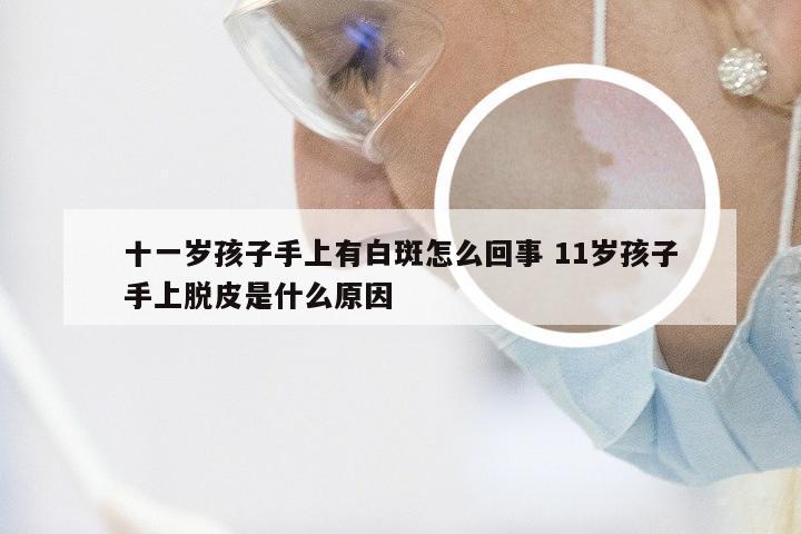 十一岁孩子手上有白斑怎么回事 11岁孩子手上脱皮是什么原因