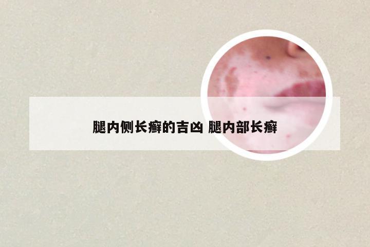 腿内侧长癣的吉凶 腿内部长癣