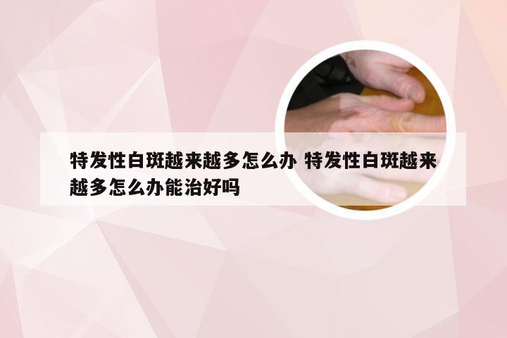 特发性白斑越来越多怎么办 特发性白斑越来越多怎么办能治好吗